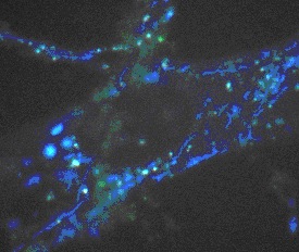 Fig. 1: il fibroblasto colorato di blu visto con il microscopio a luce polarizzata